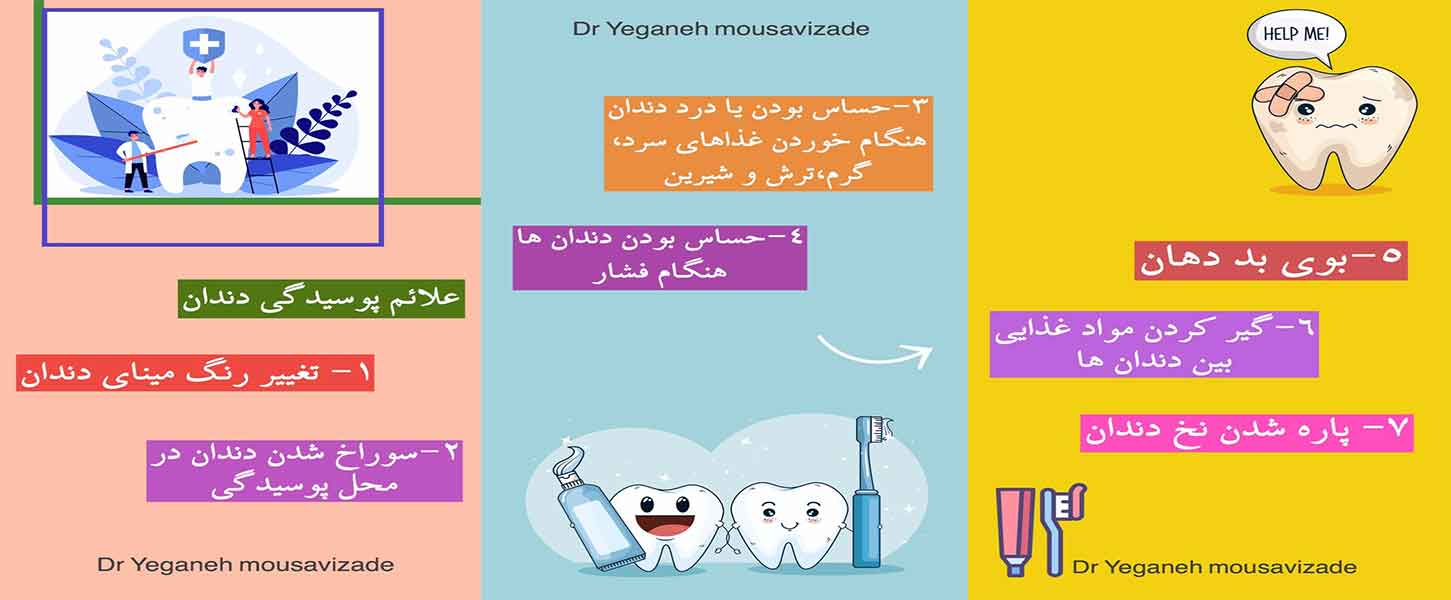 علائم-پوسیدگی-دندان-در-کودکان