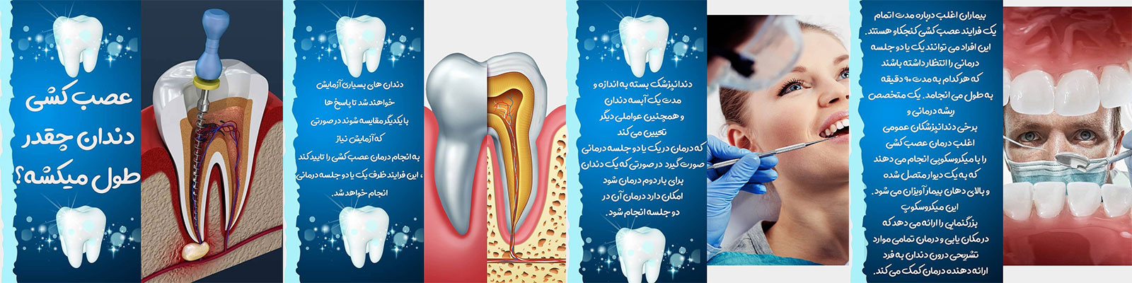 طول-مدت-عصب-کشی-دندان