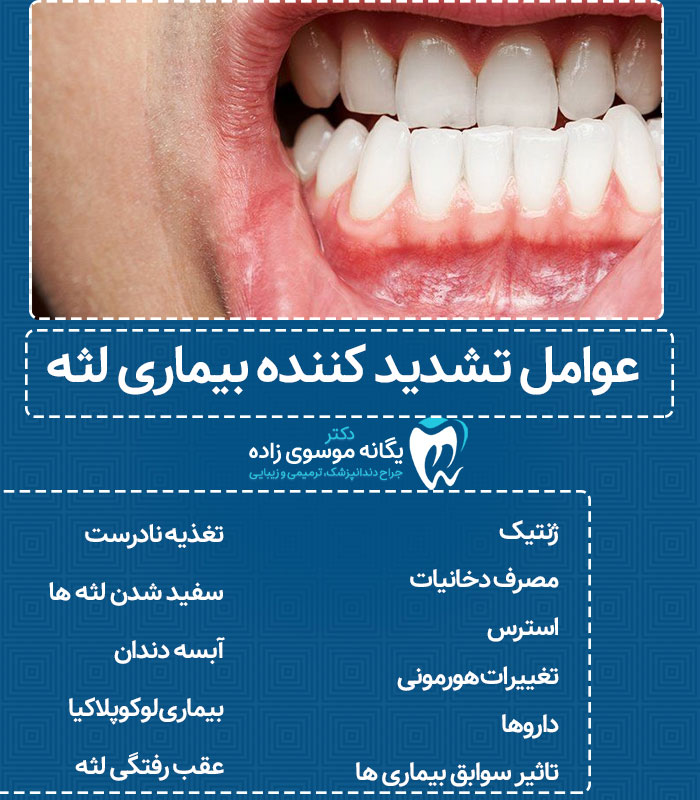 عوامل-تشدید-کننده-بیماری-لثه