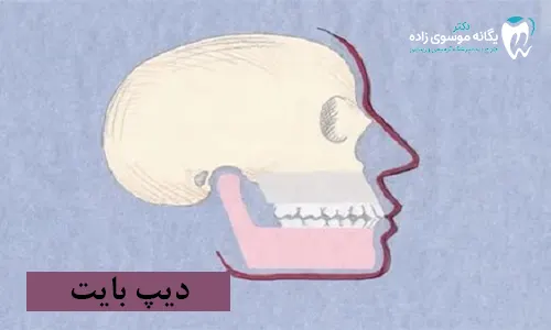 دیپ بایت