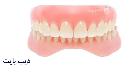 دیپ بایت