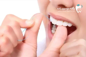 نخ دندان چیست