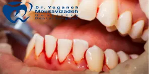 خون ریزی و درد دندان