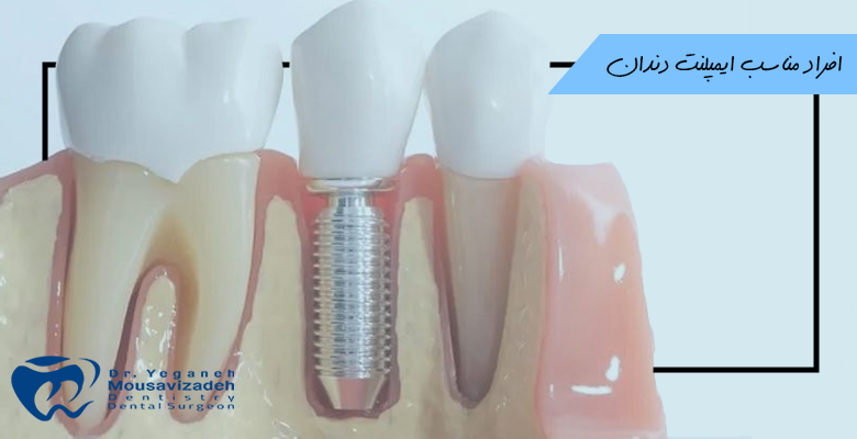 افراد مناسب ایمپلنت دندانی