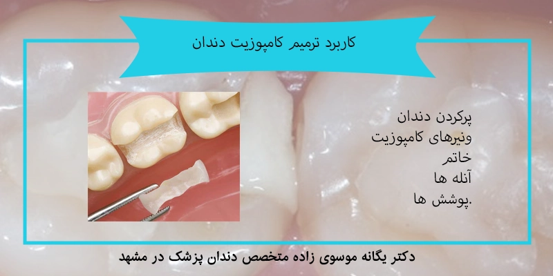 کاربرد ترمیم کامپوزیت