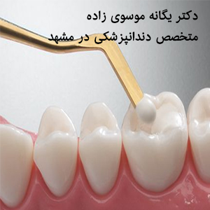 ترمیم کامپوزیت دندان