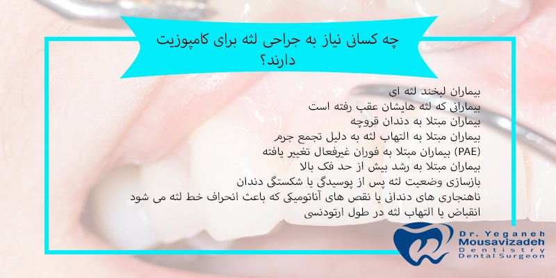 جراحی لثه قبل از کامپوزیت