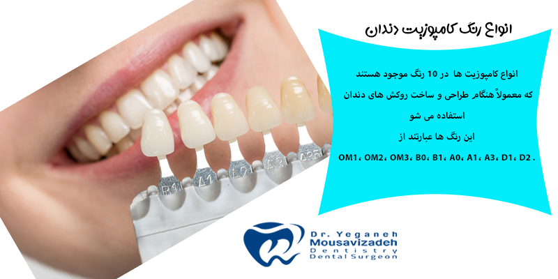 انواع رنگ کامپوزیت دندان