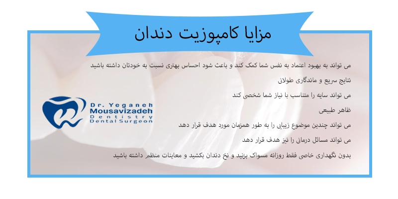 مزایا کامپوزیت دندان جلو