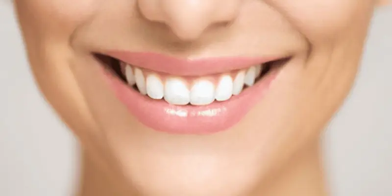 تخصص عامل موثر بر هزینه اصلاح طرح لبخند