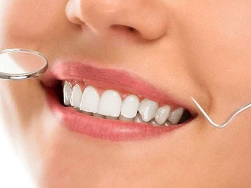 هزینه اصلاح طرح لبخند سال 1402 در مشهد