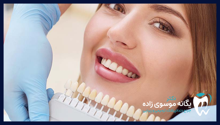 مزایای کامپوزیت و لمینت 