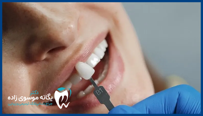 ریمو کامپوزیت دندان به چند دلیل انجام می شود؟