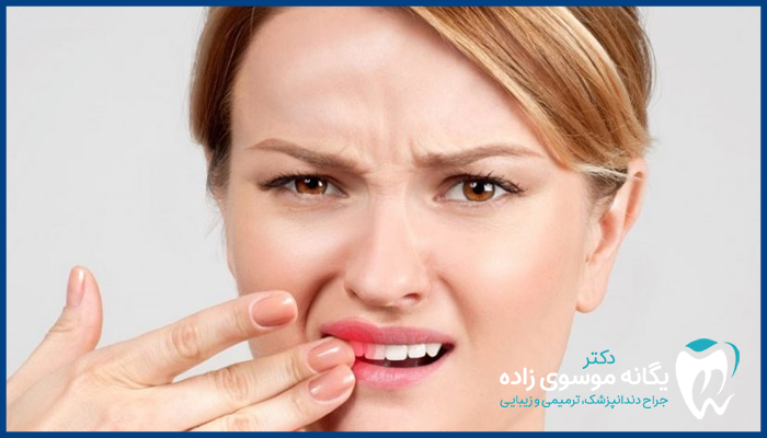 دلایل درد بعد از کامپوزیت دندان