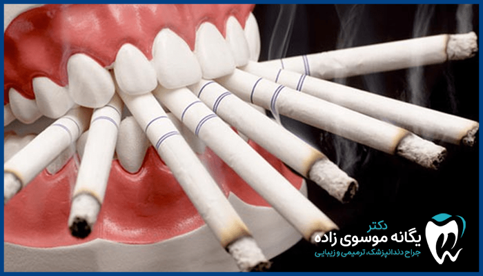 تاثیر سیگار بر فرآیند چسبندگی لمینت
