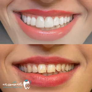 نمونه کار اصلاح طرح لبخند