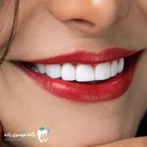 نمونه کار اصلاح طرح لبخند دکتر موسوی زاده