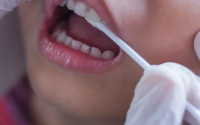 فلوئورزیس دندانی