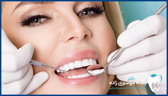 ظاهر لمینت دندان عصب کشی شده طبیعی است؟