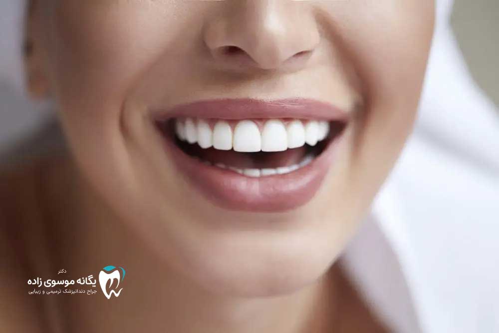 دندانپژشکی زیبایی