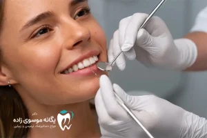 بهترین سن برای کامپوزیت دندان