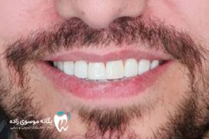 طراحی لبخند دیجیتال چیست؟