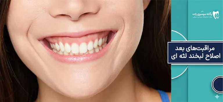 مراقبت های بعد از اصلاح لبخند لثه ای 