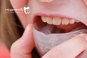 پیشگیری و درمان ساییدگی دندان چیست؟