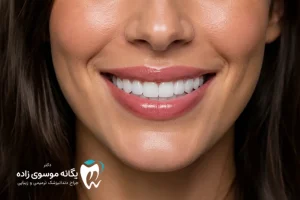 طراحی لبخند و فرم لبها