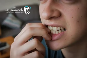 عاداتی که دندان را خراب می‌کند