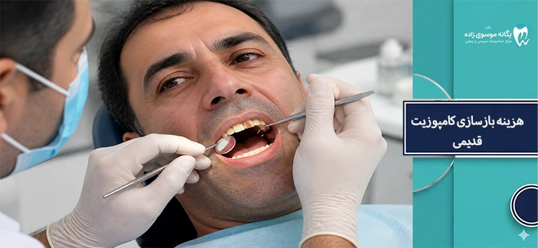 هزینه بازسازی کامپوزیت قدیمی