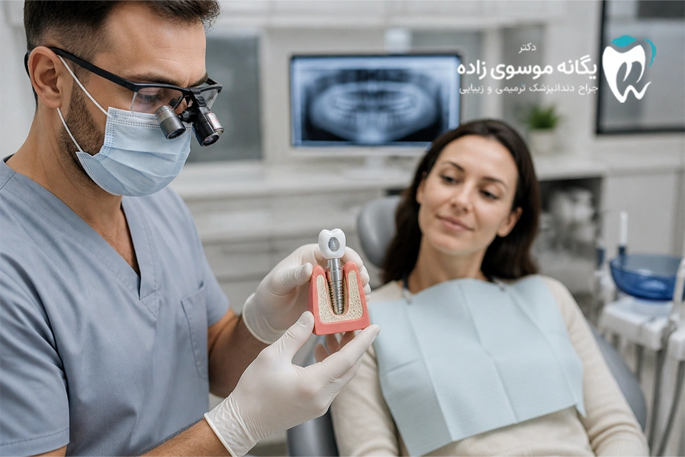 اجزای ایمپلنت دندان