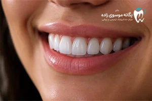 کامپوزیت لبه شیشه ای